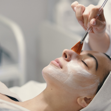 CHEMICAL PEELS