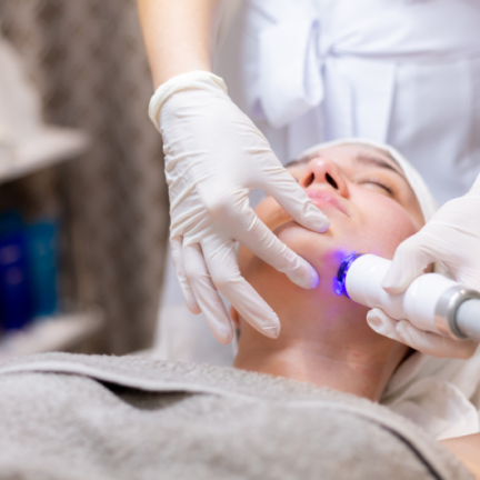 LASER TONING