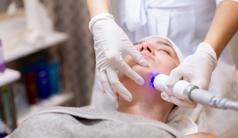 LASER TONING LASER TONING